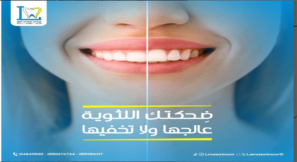 هل تعاني من تشوهات في الأسنان؟ اكتشف أفضل حلول تجميل الأسنان في المدينة المنورة مع عيادات لمسات النور. تقويم، فينير، زراعة، تبييض والمزيد – استعد ثقتك وابتسامتك الآن!