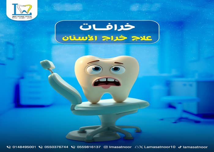 حشو تجميلي للاسنان
