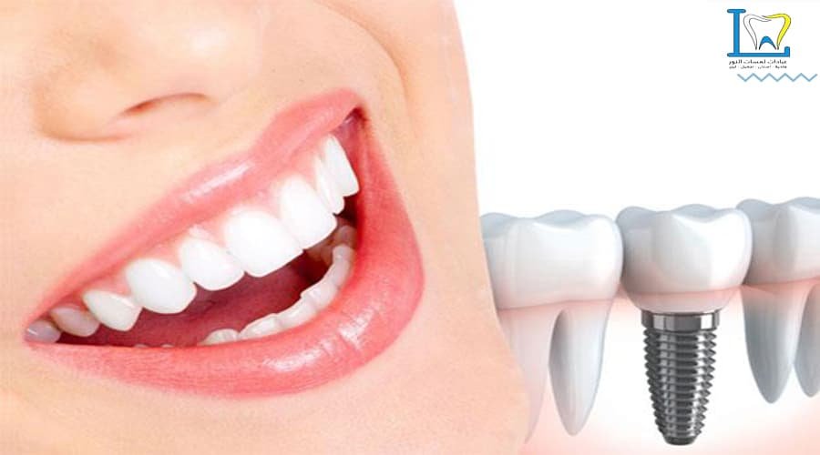 أفضل أطباء زراعة الأسنان بالمدينة المنورة