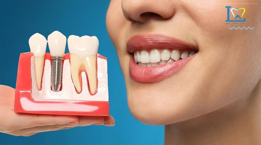 افضل عيادة زراعة اسنان بالمدينة المنورة
