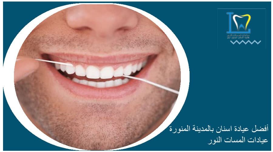 حشوات كمبوزيت تجميلية