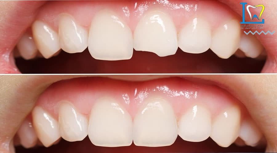 مركز تجميل الأسنان المدينة المنورة