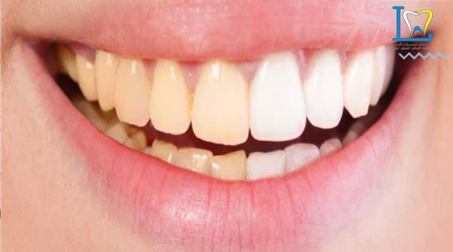 مستوصف اسنان تجميل بالمدينة المنورة