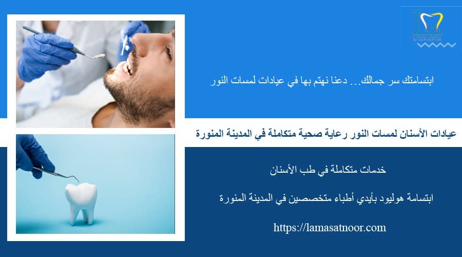 افضل عيادة لتبييض الاسنان بالمدينة المنورة