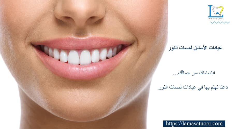 افضل عيادة لتبييض الاسنان