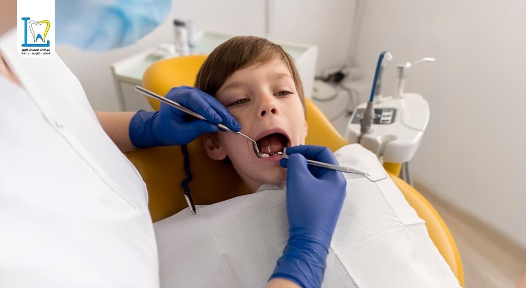 خلع الاسنان اللبنية المسوسة