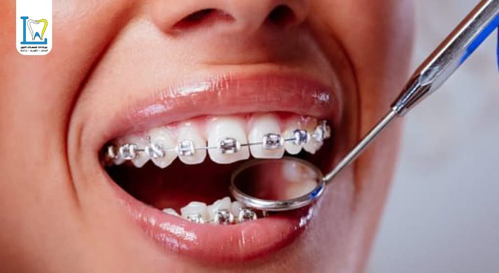 مستوصف تقويم أسنان