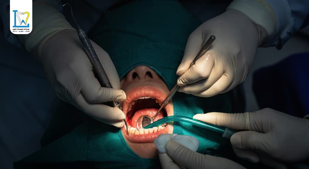 جراحة الفم و الاسنان