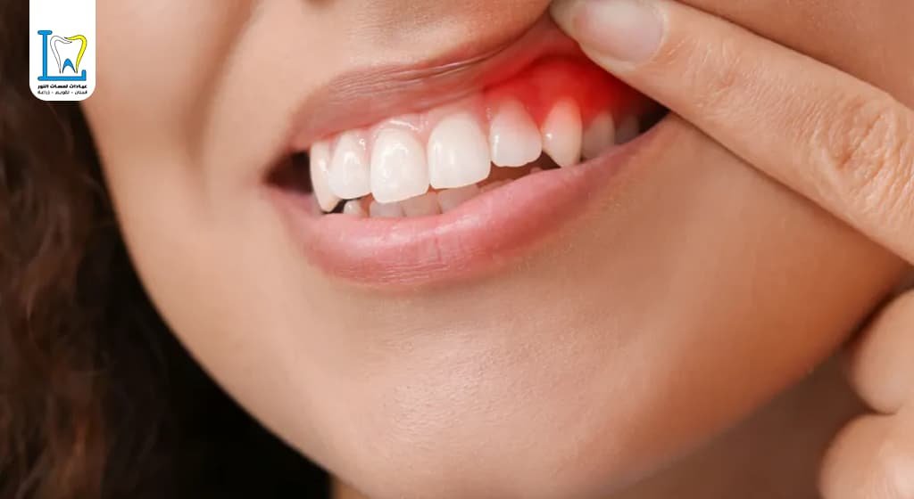 افضل دكتور علاج اللثة