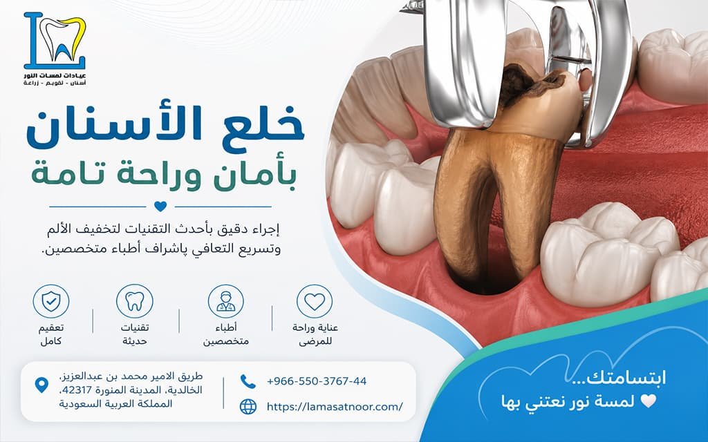 كيف اعرف ان الضرس يحتاج خلع