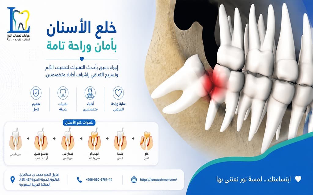 علاج ألم ضرس العقل المسوس
