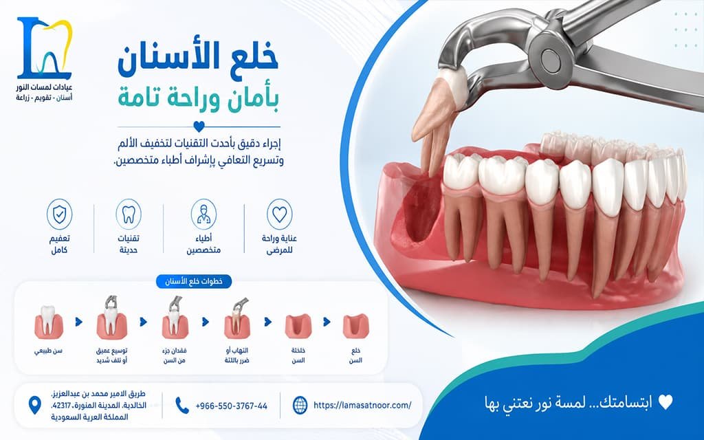 علاج ألم ضرس العقل المسوس
